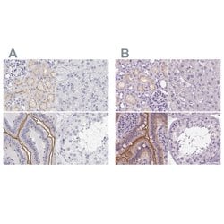 Invitrogen C19orf21 Polyclonal Antibody 100 &mu;L; Unconjugated:Antibodies,
