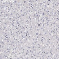 Invitrogen C19orf21 Polyclonal Antibody 100 &mu;L; Unconjugated:Antibodies,