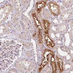 UNC13B Polyclonal Antibody 100 &mu;L | Buy Online | Thermo Scientific | Fisher Scientific