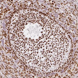 Invitrogen NUCKS1 Polyclonal Antibody 100 &mu;L; Unconjugated:Antibodies,