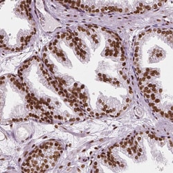 Invitrogen NUCKS1 Polyclonal Antibody 100 &mu;L; Unconjugated:Antibodies,