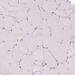 Invitrogen COX6A1 Polyclonal Antibody 100 &mu;L | Buy Online | Invitrogen&trade; | Fisher Scientific