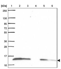 Invitrogen COX6A1 Polyclonal Antibody 100 &mu;L | Buy Online | Invitrogen&trade; | Fisher Scientific
