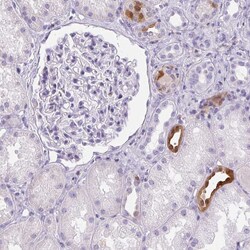 S100A2 Polyclonal Antibody 100 &mu;L | Buy Online | Thermo Scientific | Fisher Scientific