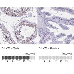 C2orf70 Polyclonal Antibody:Antibodies, Polyclonal