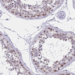 C2orf70 Polyclonal Antibody:Antibodies, Polyclonal