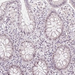 Invitrogen BATF2 Polyclonal Antibody 100 &mu;L; Unconjugated:Antibodies,