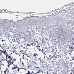 Invitrogen DAGLA Polyclonal Antibody 100 &mu;L; Unconjugated:Antibodies,