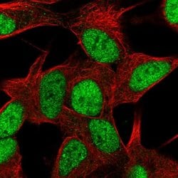 Invitrogen ZNF781 Polyclonal Antibody 100 &mu;L; Unconjugated:Antibodies,