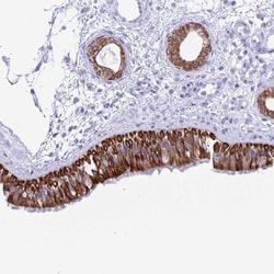Invitrogen ZNF781 Polyclonal Antibody 100 &mu;L; Unconjugated:Antibodies,