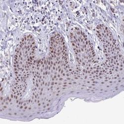 Invitrogen ZNF691 Polyclonal Antibody 100 &mu;L; Unconjugated:Antibodies,