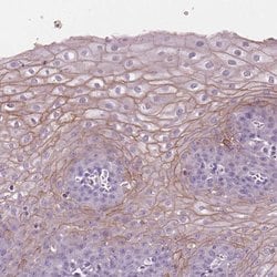 Invitrogen SBSN Polyclonal Antibody 100 &mu;L; Unconjugated:Antibodies,