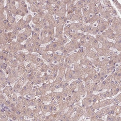 Invitrogen NKG2E Polyclonal Antibody 100 &mu;L; Unconjugated:Antibodies,