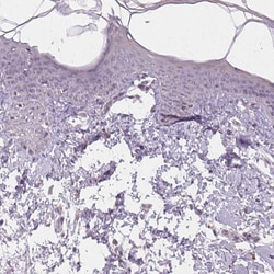 Invitrogen NKG2E Polyclonal Antibody 100 &mu;L; Unconjugated:Antibodies,