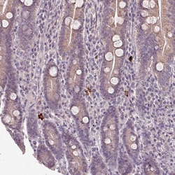 Invitrogen NKG2E Polyclonal Antibody 100 &mu;L; Unconjugated:Antibodies,