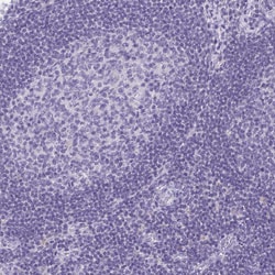 Invitrogen TAGLN3 Polyclonal Antibody 100 &mu;L | Buy Online | Invitrogen&trade; | Fisher Scientific