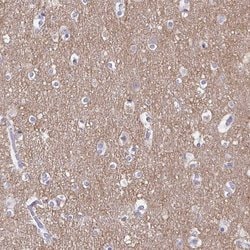 Invitrogen TAGLN3 Polyclonal Antibody 100 &mu;L | Buy Online | Invitrogen&trade; | Fisher Scientific