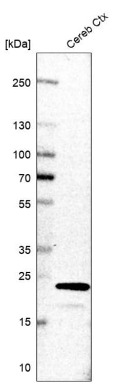 Invitrogen TAGLN3 Polyclonal Antibody 100 &mu;L | Buy Online | Invitrogen&trade; | Fisher Scientific