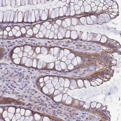 Invitrogen LMF2 Polyclonal Antibody 100 &mu;L; Unconjugated:Antibodies,