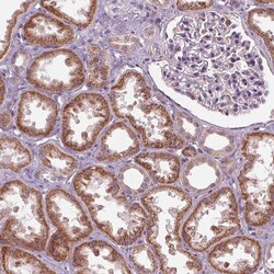 Invitrogen ZNF605 Polyclonal Antibody 100 &mu;L; Unconjugated:Antibodies,
