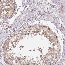 Invitrogen EMC6 Polyclonal Antibody 100 &mu;L; Unconjugated:Antibodies,