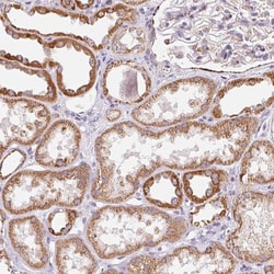 Invitrogen GIPC2 Polyclonal Antibody 100 &mu;L; Unconjugated:Antibodies,