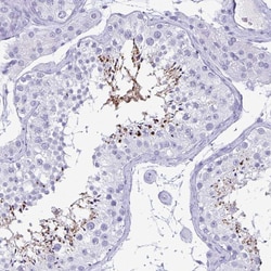 Invitrogen BPIFA3 Polyclonal Antibody 100 &mu;L; Unconjugated:Antibodies,