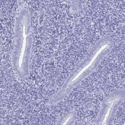 Invitrogen BPIFA3 Polyclonal Antibody 100 &mu;L; Unconjugated:Antibodies,