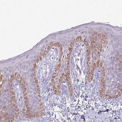 Invitrogen SLC35E2 Polyclonal Antibody 100 &mu;L; Unconjugated:Antibodies,
