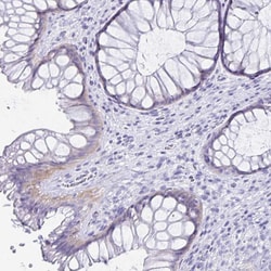 Invitrogen C19orf73 Polyclonal Antibody 100 &mu;L; Unconjugated:Antibodies,