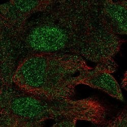 Invitrogen C19orf73 Polyclonal Antibody 100 &mu;L; Unconjugated:Antibodies,