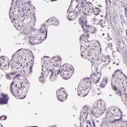 AWAT2 Polyclonal Antibody:Antibodies, Polyclonal