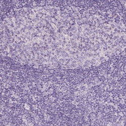 AWAT2 Polyclonal Antibody:Antibodies, Polyclonal