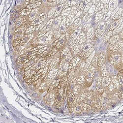 AWAT2 Polyclonal Antibody:Antibodies, Polyclonal