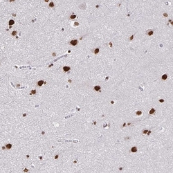 Invitrogen ZNF579 Polyclonal Antibody 100 &mu;L; Unconjugated:Antibodies,