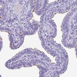 Invitrogen ODF3B Polyclonal Antibody 100 &mu;L; Unconjugated:Antibodies,