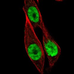 Invitrogen HOXB13 Polyclonal Antibody 100 &mu;L; Unconjugated:Antibodies,