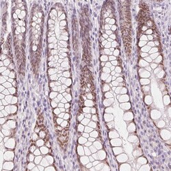 Invitrogen HOXB13 Polyclonal Antibody 100 &mu;L; Unconjugated:Antibodies,