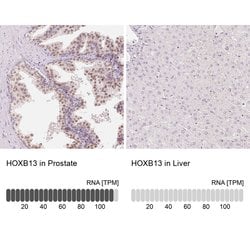 Invitrogen HOXB13 Polyclonal Antibody 100 &mu;L; Unconjugated:Antibodies,