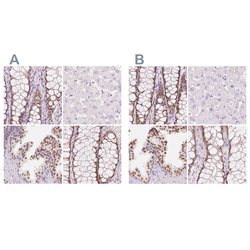 Invitrogen HOXB13 Polyclonal Antibody 100 &mu;L; Unconjugated:Antibodies,
