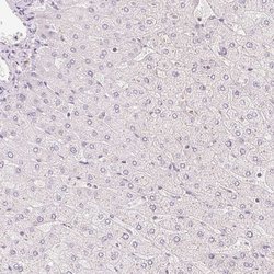 Invitrogen HOXB13 Polyclonal Antibody 100 &mu;L; Unconjugated:Antibodies,