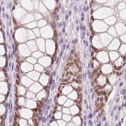 Invitrogen HOXB13 Polyclonal Antibody 100 &mu;L; Unconjugated:Antibodies,