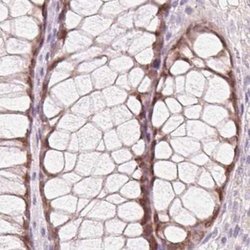 Invitrogen HOXB13 Polyclonal Antibody 100 &mu;L; Unconjugated:Antibodies,
