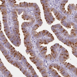 Invitrogen DYNC2LI1 Polyclonal Antibody 100 &mu;L; Unconjugated:Antibodies,