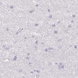 Invitrogen TMEM72 Polyclonal Antibody 100 &mu;L; Unconjugated:Antibodies,