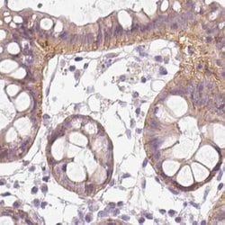 Invitrogen TMEM72 Polyclonal Antibody 100 &mu;L; Unconjugated:Antibodies,