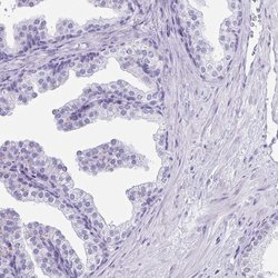 Invitrogen CD164L2 Polyclonal Antibody 100 &mu;L; Unconjugated:Antibodies,