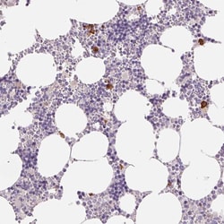 IFIT1B Polyclonal Antibody:Antibodies, Polyclonal