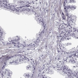 Invitrogen NANOS3 Polyclonal Antibody 100 &mu;L; Unconjugated:Antibodies,