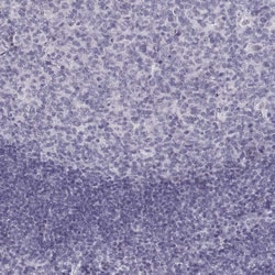 Invitrogen NANOS3 Polyclonal Antibody 100 &mu;L; Unconjugated:Antibodies,